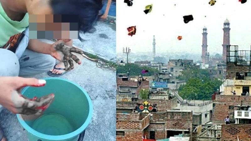 Lahore boy escapes serious throat injury after slit by kite string