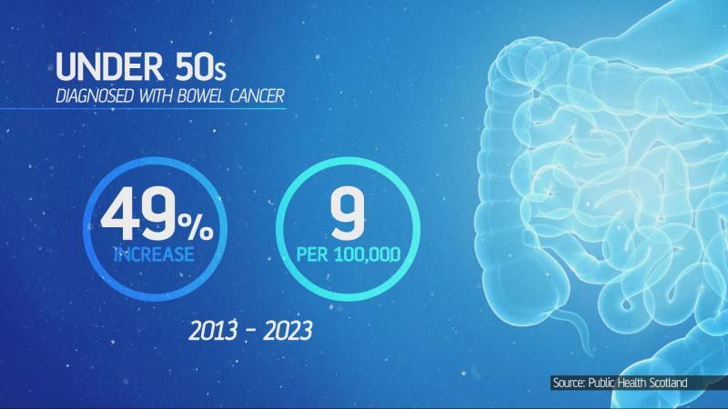 Doctors hope UK archive can solve under-50s bowel cancer mystery