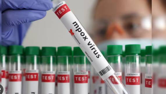 Second m-pox death case reported in Pakistan with local transmission evidences