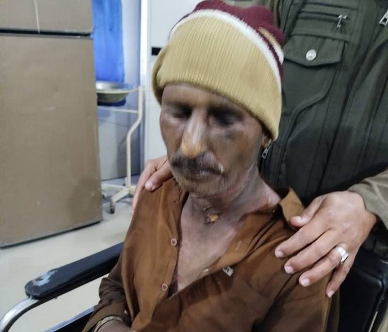 Man set on fire by wife, children in Narang Mandi; dies of burns