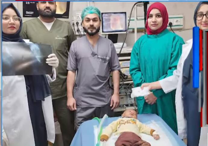 Doctors remove iron washer from little boy’s stomach at Lahore hospital