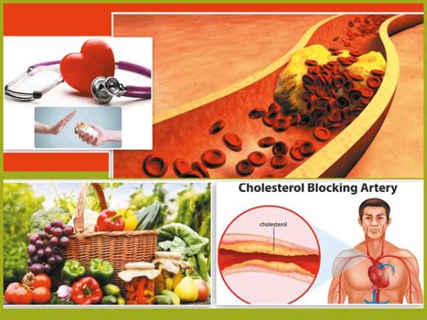 High cholesterol: the ‘silent killer’ that raises heart, stroke risks