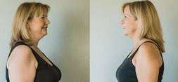 Easy tips and tricks to lose 10kgs that no one ever told you before  