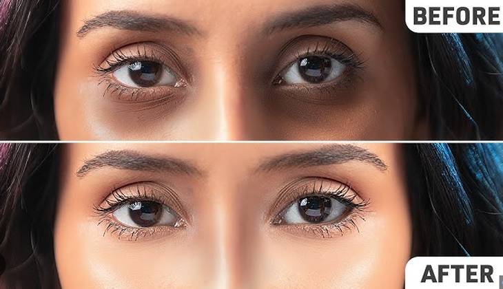 Tips and tricks to rejuvenate dark circles under eyes 