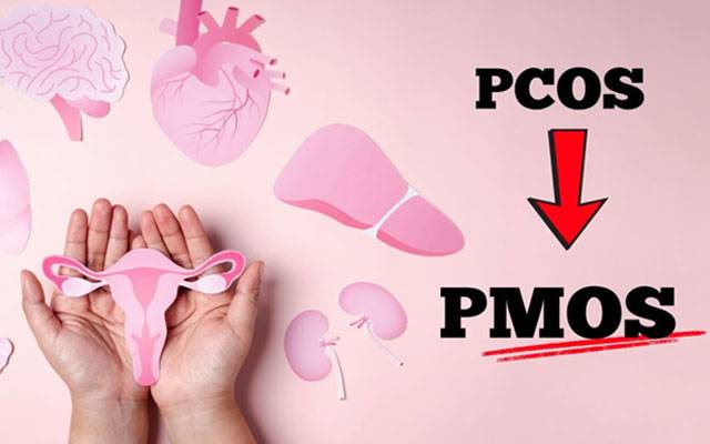 PCOS officially has a new name 