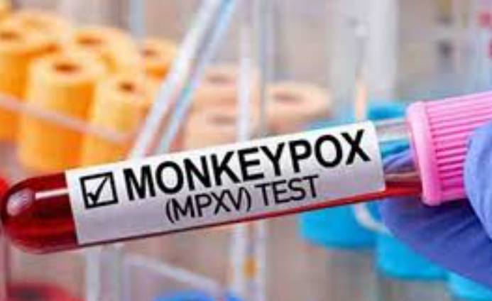 Monkeypox suspect under treatment at Faisalabad hospital