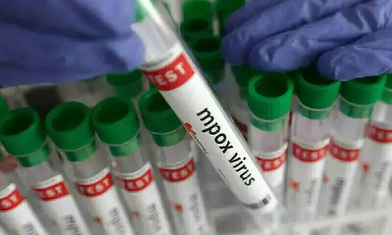 Fifth suspected mpox patient admitted to Nishtar Hospital
