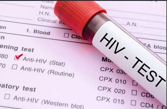 Deported passengers to undergo HIV screening at Pakistan airports