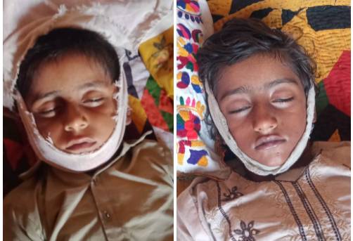 Boy, girl lose lives after falling into pond while playing near Shikarpur village 