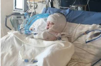 Family sets on fire little girl suspected of possessing demon