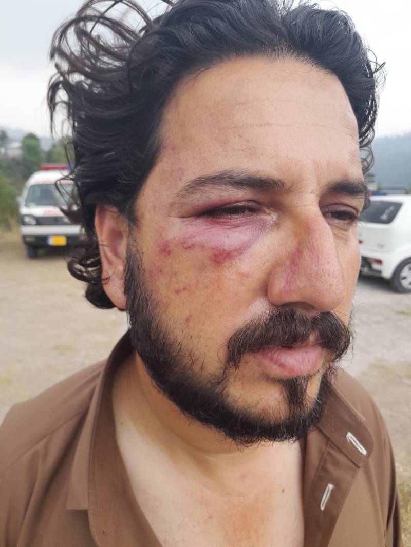 Two men injured after abduction and assault by masked men in AJK