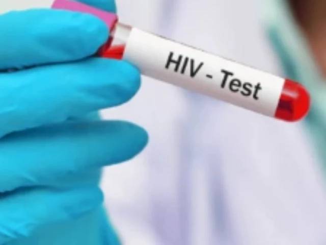 Total HIV cases at Karachi’s KBV hospital rise to 80