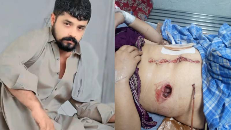 Husband shoots wife after dispute over Rs100 in Khanpur