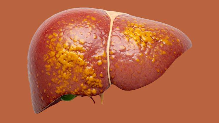 Diabetes drug may help repair liver damage