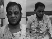 Karachi University Professor reaches settlement with assault suspect