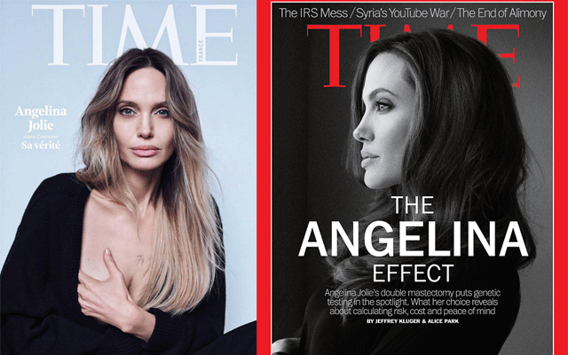 Angelina Jolie reveals her mastectomy scars in cover shoot for Time magazine